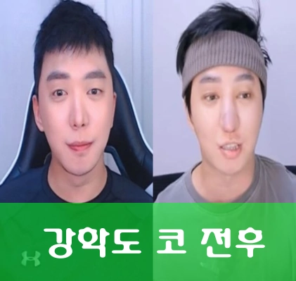 강학두 코 최근영상