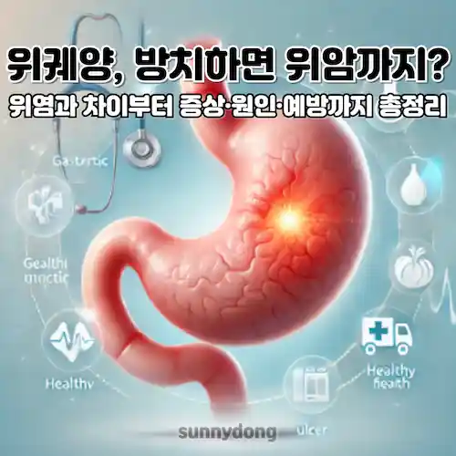 위궤양, 위염과 차이부터 증상·원인·예방까지 총정리 썸네일