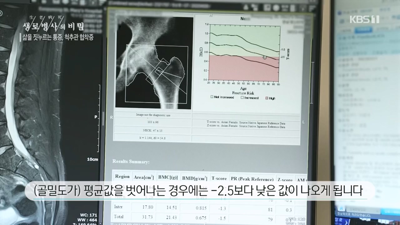 생로병사의 비밀.E866.230427p.H264-F1RST.mp4_20230427_202707.316.jpg