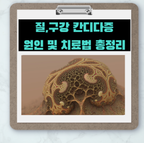  당을 원하게 만드는 '칸디다증' 원인 및 치료법