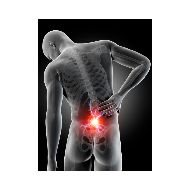 허리 근육통 원인 근막통증증후군 치료법