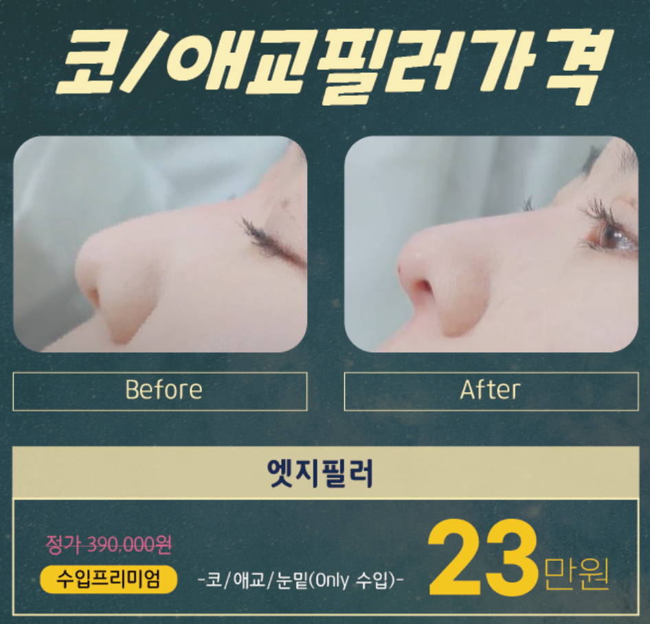 이마 필러 가격 효과 부작용 후기