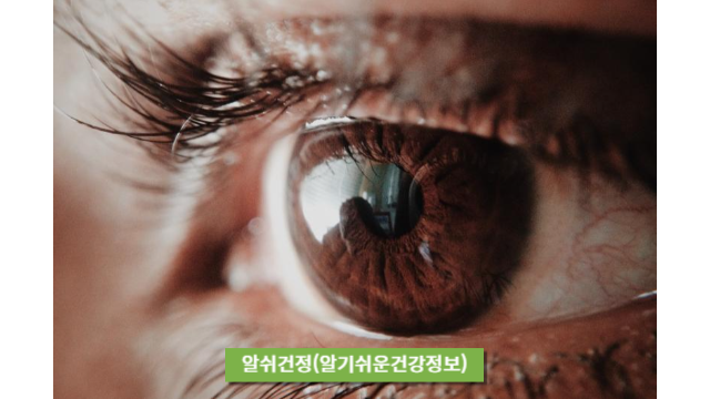 눈