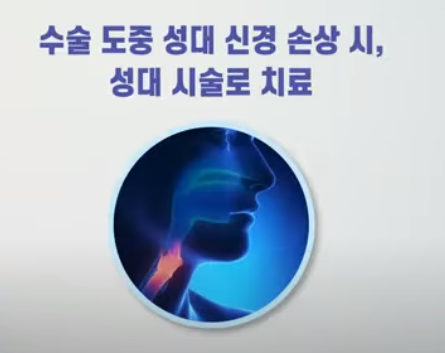 갑상선 수술 성대 손상