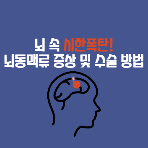  뇌 속 시한폭탄 뇌동맥류 증상 수술 후유증 코일색전술 클립결찰술