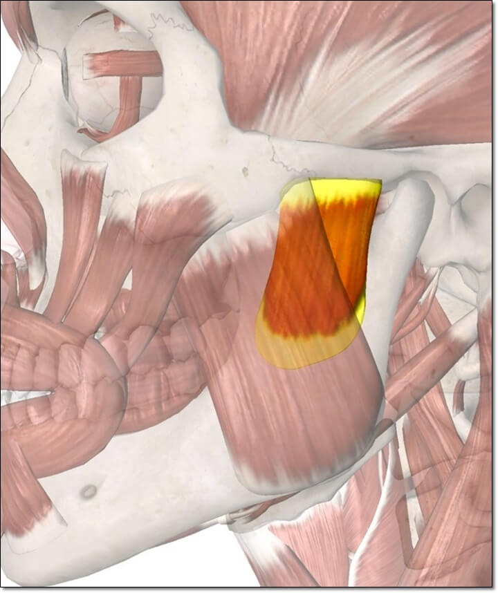 교근 해부학 그림으로 교근의 심층부를 노란색으로 표시한 그림