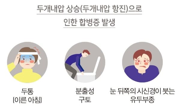 뇌종양-증상