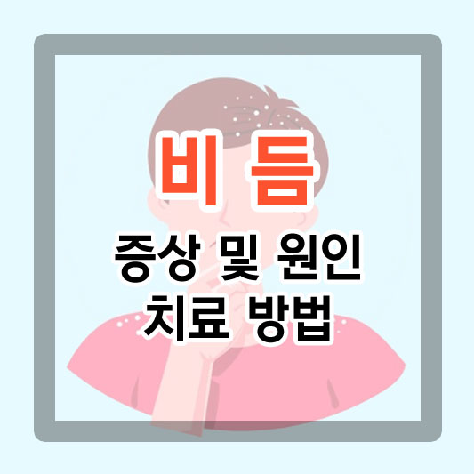  비듬 증상 및 원인, 치료 방법으로 검은 옷 편하게 입어보기.