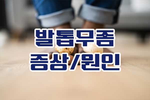  발톱 무좀 증상 원인 발톱에 곰팡이?