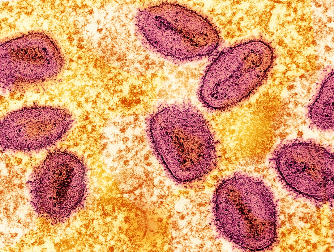monkeypox