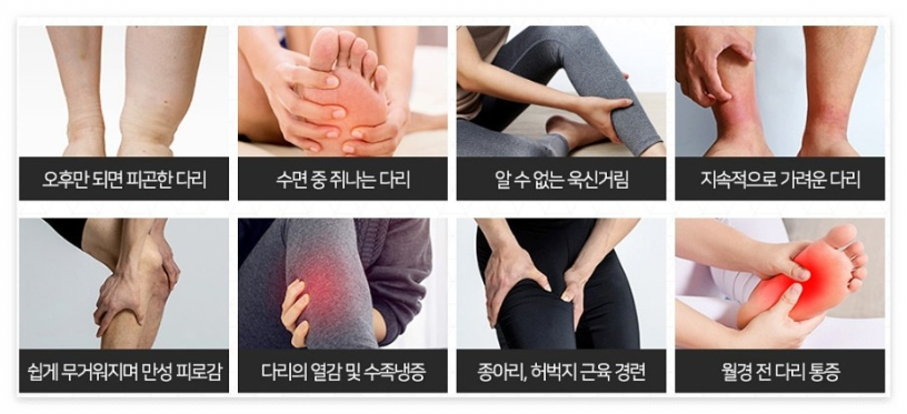 하지부종의 증상들