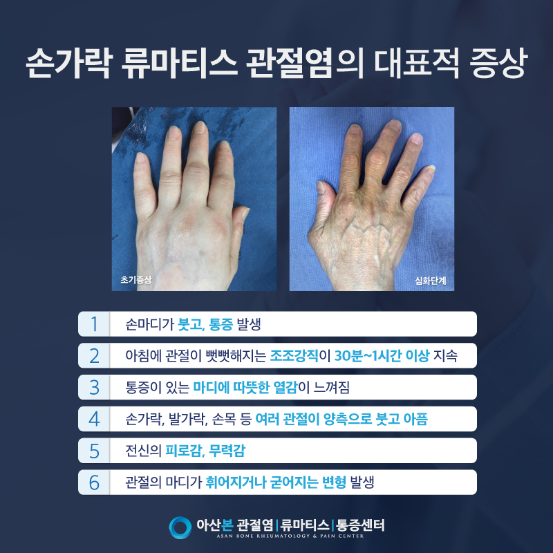 정확한 원인을 찾아 손가락 마디 부위를 다친 관절 4