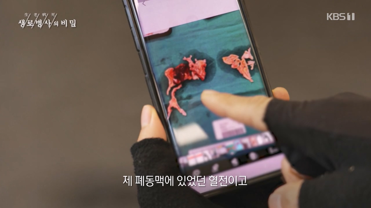 생로병사의 비밀.E900.240215p-NEXT.mp4_20240215_202855.447.jpg