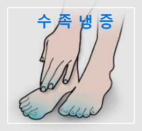 수족냉증