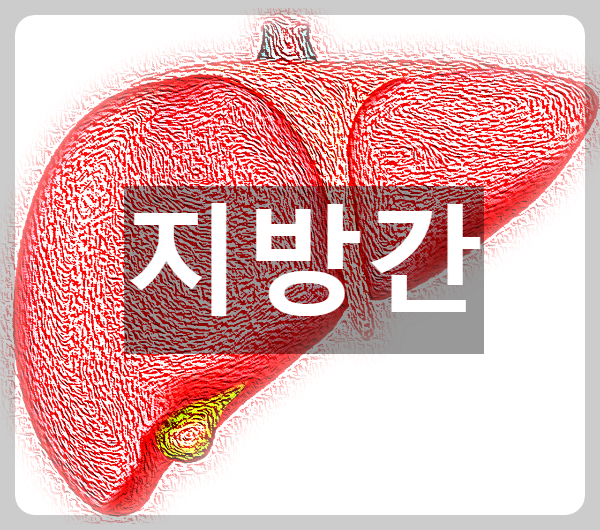  무증상이라서 더 무서운 질환인 지방간