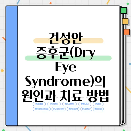 건성안 증후군(Dry Eye Syndrome)의 원인과 치료 방법
