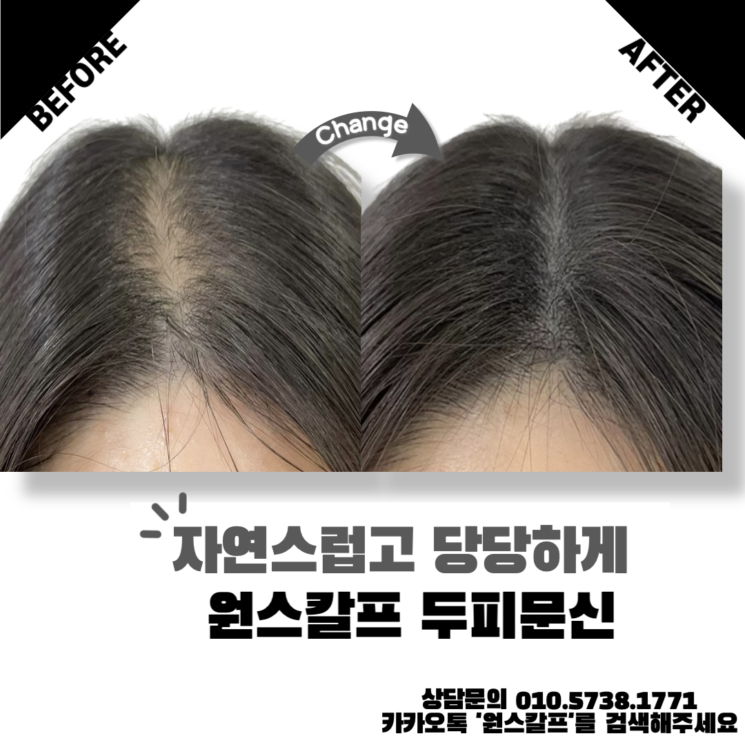  부산 서면두피문신 최고로 자연스러운곳