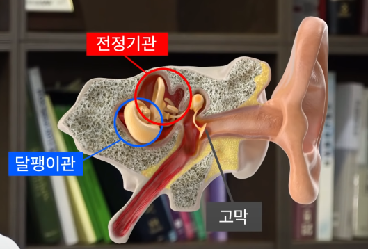 이석증 관련사진