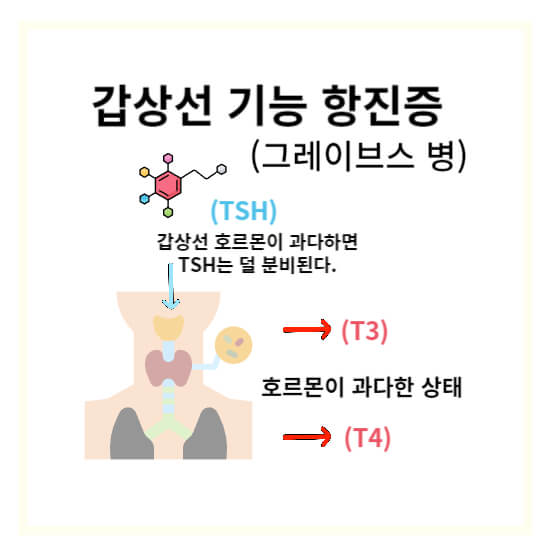 갑상선 기능 항진증에 대한 설명