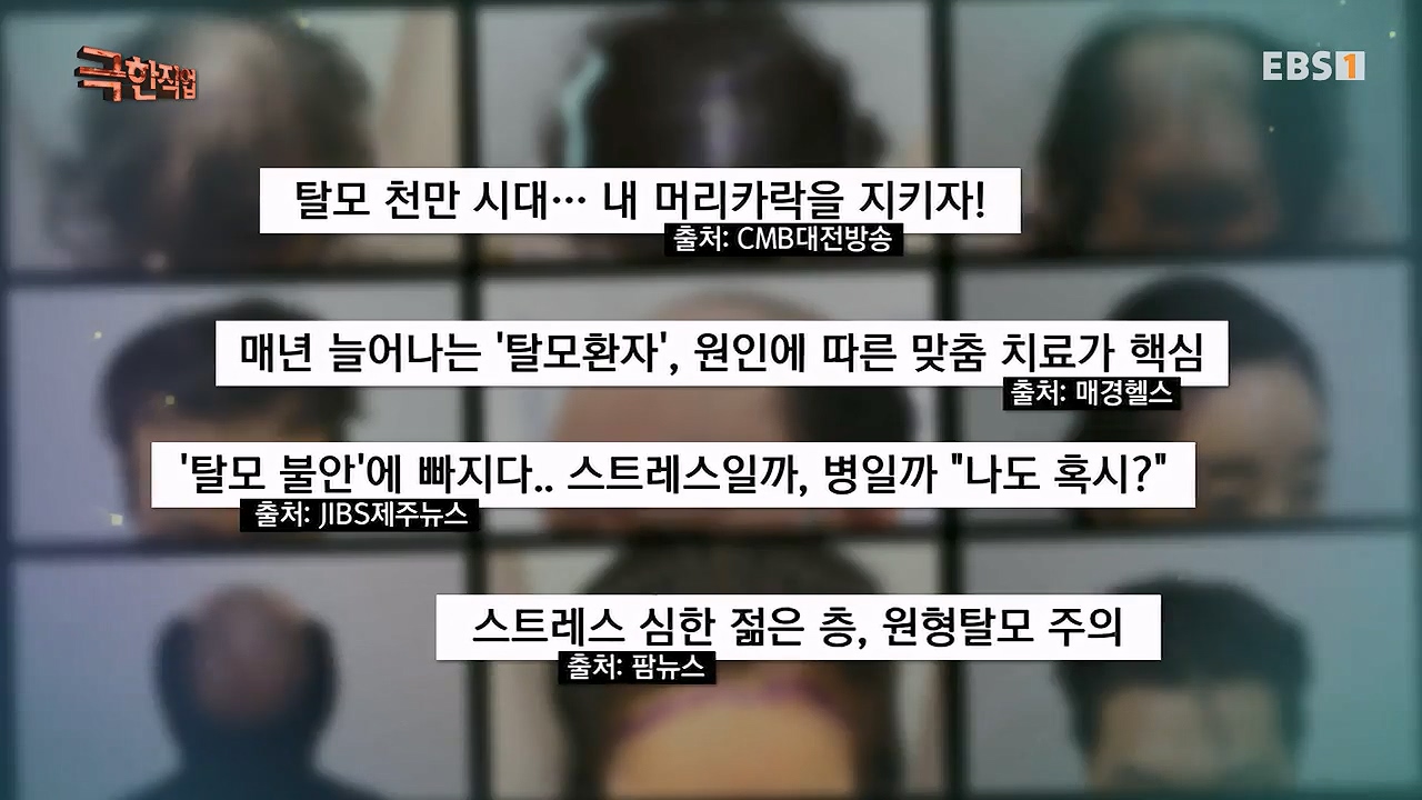 TV - 전 국민의 평생학교 EBS탈모 고민 해결사.mp4_20230508_195758.093.jpg