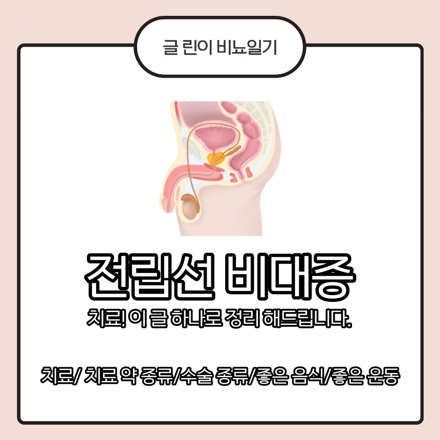  전립선 비대증 치료! 이 글 하나로 정리 해드립니다.