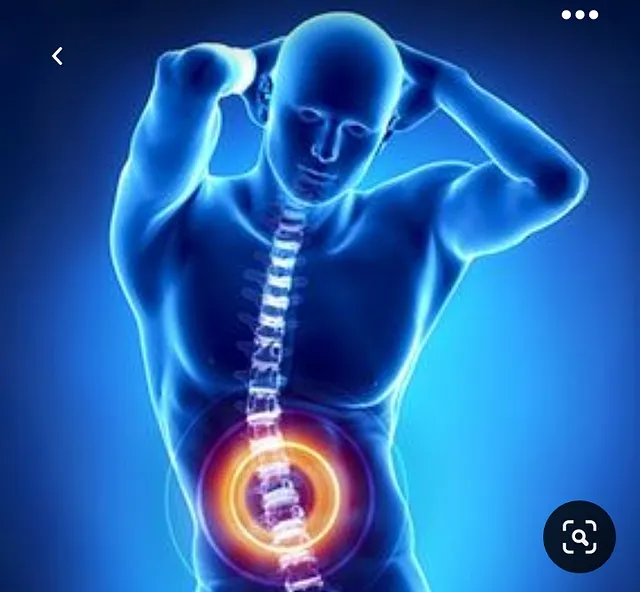  척추증에 대한 이해: 원인, 증상 및 치료 옵션