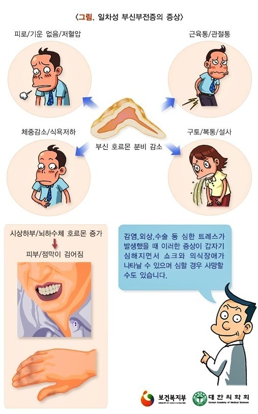 부신 기능 저하증