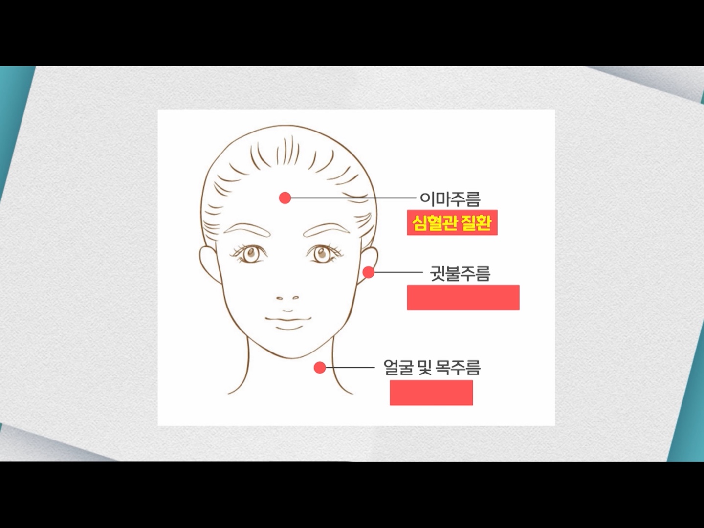  기분좋은날 다시보기 3426회 주름편
