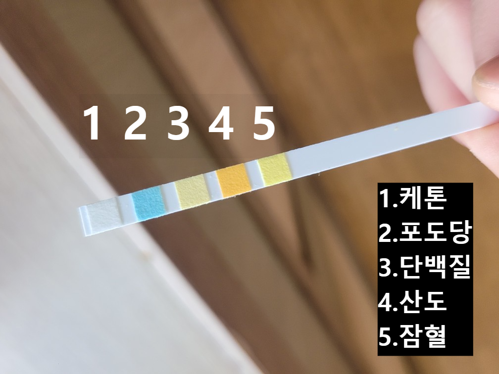 초등학교 소변검사 키트의 색 변화 반응: 검사 결과 해석