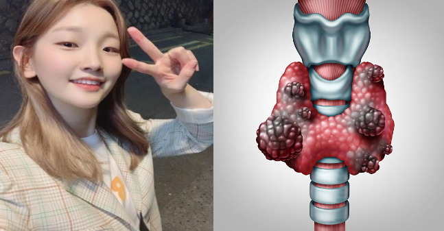 보험
db 손해 보험
삼성 화재 다이렉트
kb 손해 보험
4 대 보험
건강 보험
동부 화재
자동차 보험
현대 해상 다이렉트
보험 다모아
실비 보험
동부 화재 다이렉트
건강 보험료
삼성 다이렉트
mg 손해 보험
운전자 보험
4 대 보험 계산
건강 보험료 계산
다이렉트 자동차 보험
db 다이렉트
kb 다이렉트
악사 다이렉트
실손 보험
삼성 다이렉트 자동차 보험
삼성 화재 자동차 보험
하나 손해 보험
삼성 화재 다이렉트 자동차 보험
현대 해상 자동차 보험
kb 손해 보험 다이렉트
db 손해 보험 다이렉트
실비
동부 화재 자동차 보험
삼성 자동차 보험
db 자동차 보험
의료 보험
kb 자동차 보험
실비 보험 이란
abl 생명
연금 보험
자동차 보험료 계산
치아 보험
퍼마 일 자동차 보험
오토바이 보험
디비 손해 보험
삼성 다이렉트 보험
에이스 손해 보험
사대 보험
여행자 보험
kb 다이렉트 자동차 보험
캐롯 자동차 보험