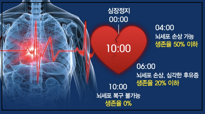 심장질환 증상 사진4