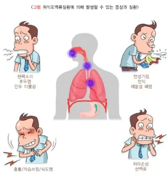 역류성 식도염 원인 초기증상 예방하는 방법_24