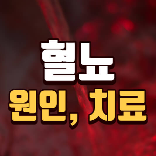  혈뇨 대표 원인 5가지와 치료 알아보기