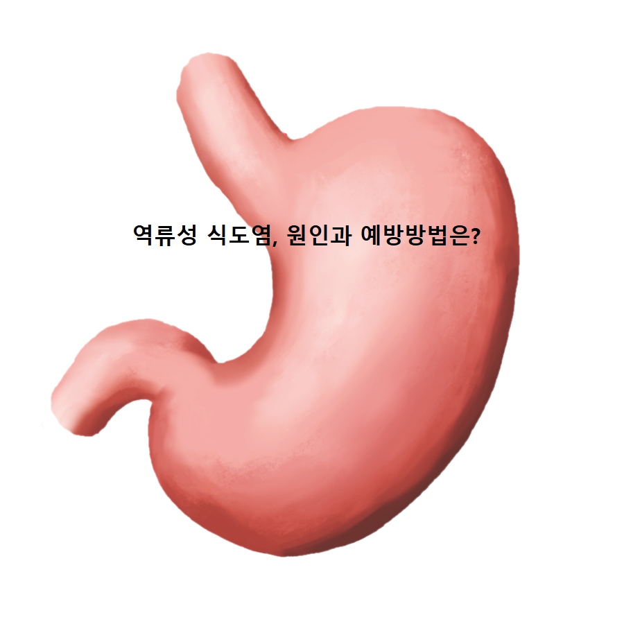 역류성 식도염