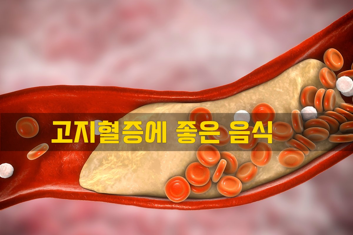  고지혈증에 좋은 음식