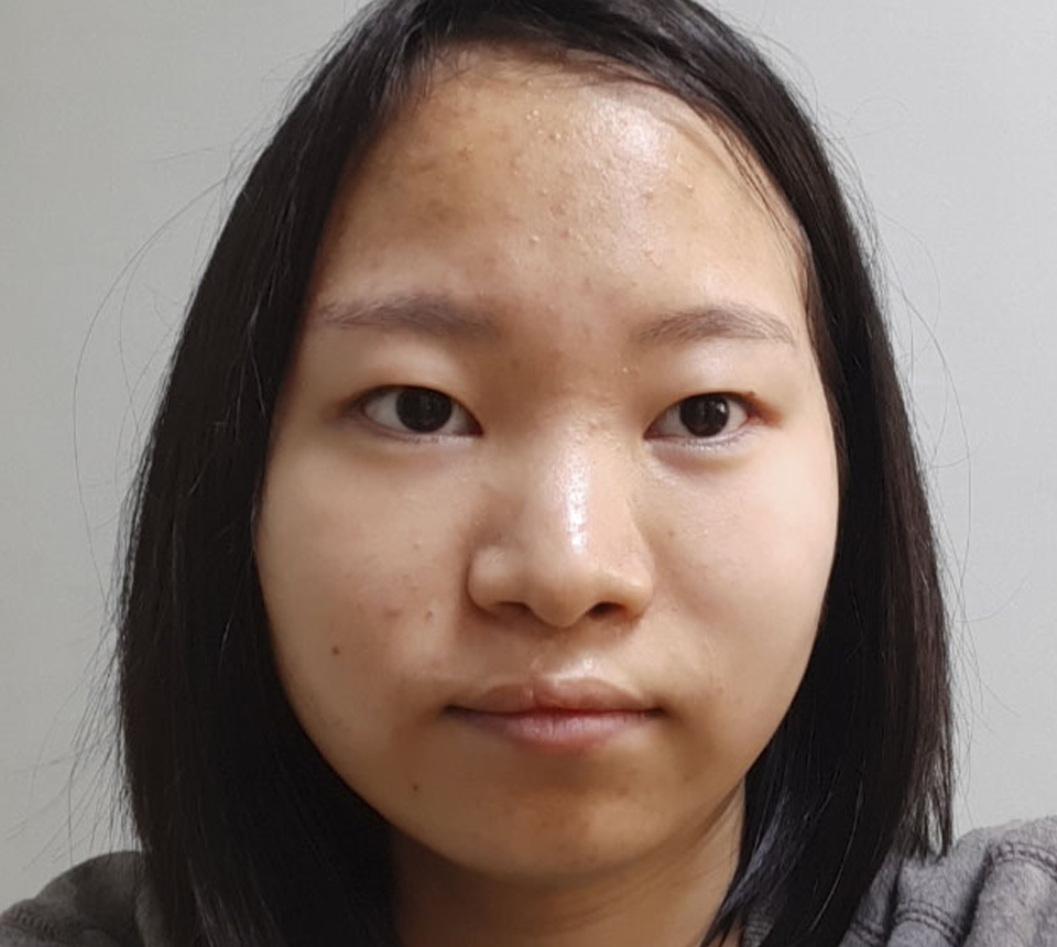 이마 이미지