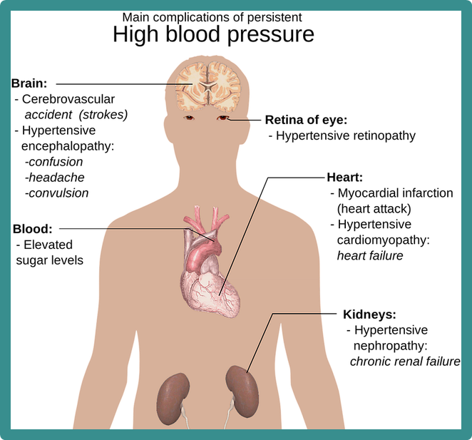 고혈압-혈액투석-원인