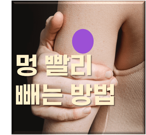  멍 빨리 빼는 법, 멍의 원인과 종류, 그리고 빠른 회복 방법