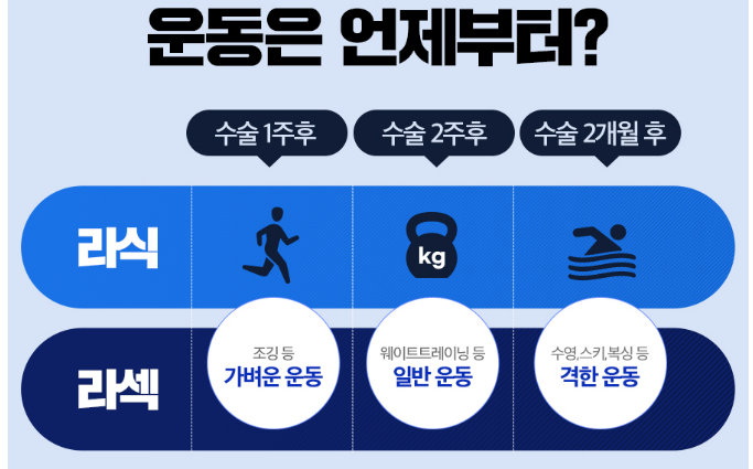 라식 라섹 가격 비교 장단점