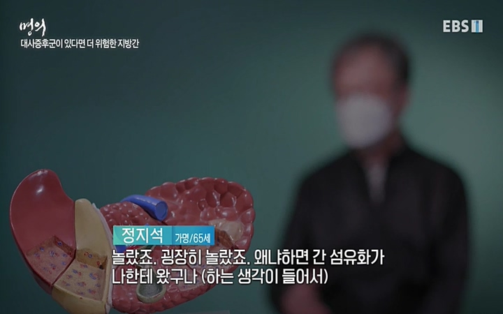 명의_ 제 764회 〈지방간의 경고 1부, 살찐 간이 위험하다〉_ 220429.avi_20220503_193637.150.jpg
