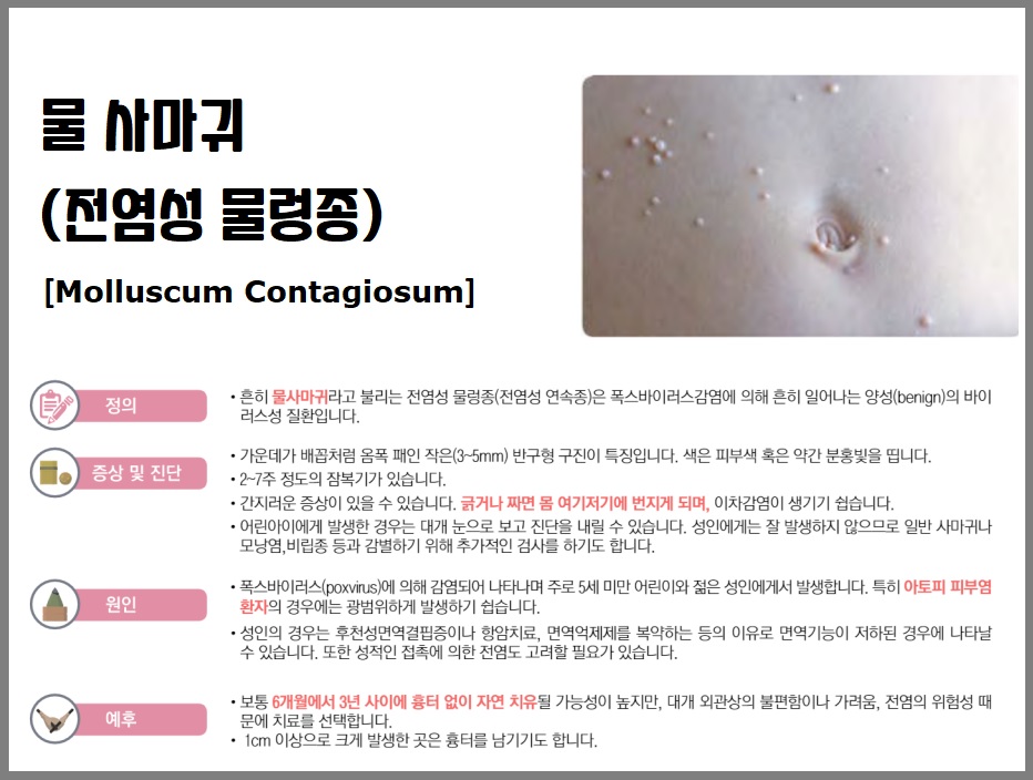 물사마귀
