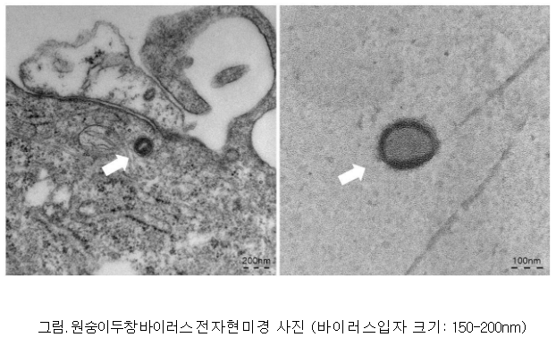 원숭이두창 바이러스 분리 성공·유전정보 공개