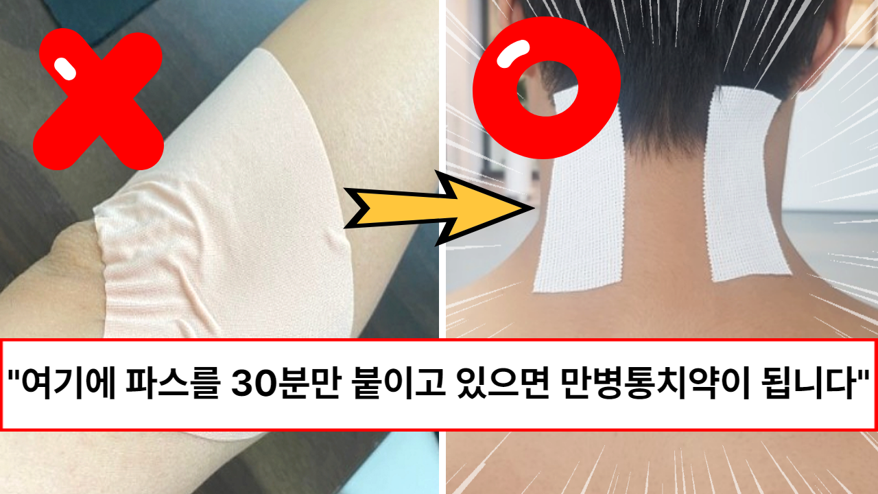 “파스를 잘못 붙이면 이렇게 됩니다” 병원에서는 가르쳐주지 않는 만병통치약이 되는 파스 붙이는 방법 (feat. 부작용)