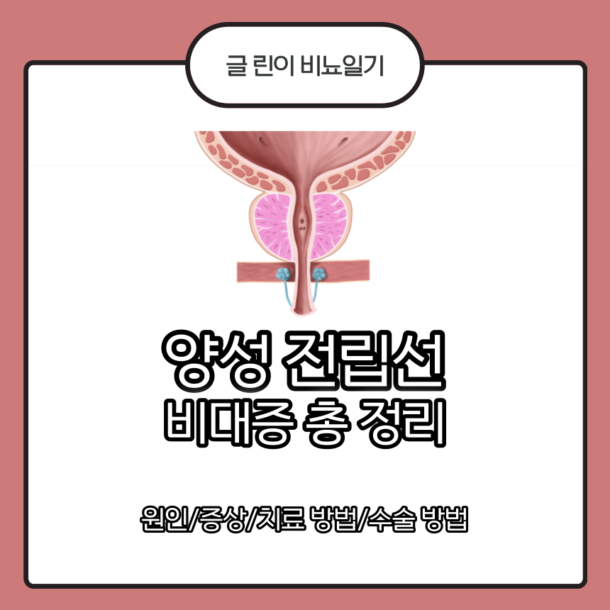  양성 전립선 비대증 총 정리 : 원인/증상/치료 방법/수술 종류