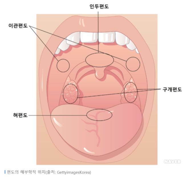 편도선이 붓는 이유