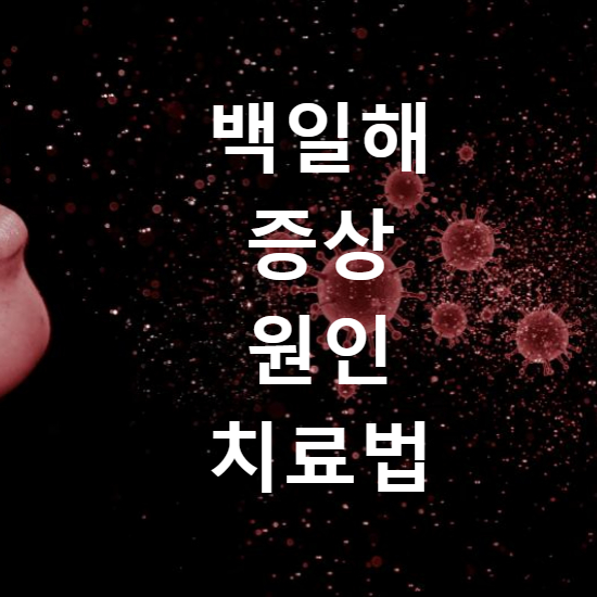 백일해 증상 원인 치료법