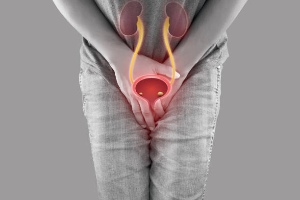 Debunking Myths About Severe Pain: Uncovering the Truth About Kidney Stones.