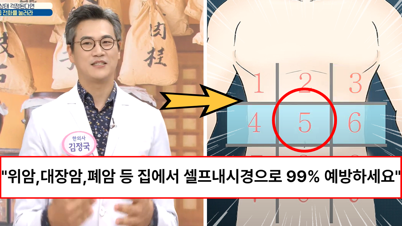“모든 암이 99% 예방됩니다” 각종 암이 자라고 있는지 집에서 스스로 할 수 있는 셀프내시경 방법