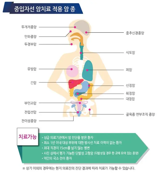 중입자-치료-적용-암-종류