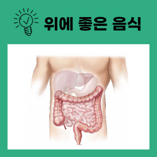  위에 좋은 음식 / 위염에 좋은 음식